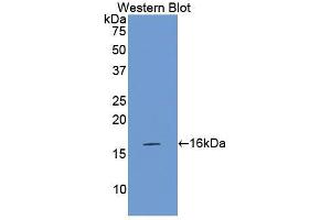 Western Blotting (WB) image for Coagulation Factor VII (F7) ELISA Kit (ABIN6574291)