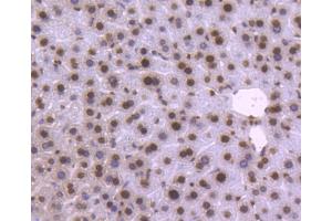 Paraformaldehyde-fixed, paraffin embedded mouse liver, Antigen retrieval by boiling in sodium citrate buffer (pH6) for 15min, Block endogenous peroxidase by 3% hydrogen peroxide for 30 minutes, Blocking buffer (normal serum) at 37°C for 20min, Antibody incubation with Histone H2B (3A6) Monoclonal Antibody  at 1:50 overnight at 4°C, followed by a conjugated secondary and DAB staining. (Histone H2B Antikörper)