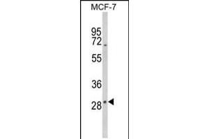 Western blot analysis of DIO2 Antibody in MCF-7 cell line lysates (35ug/lane) (DIO2 Antikörper  (AA 165-191))