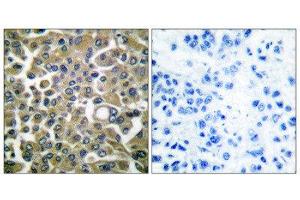 Immunohistochemistry (IHC) image for anti-Keratin 16 (KRT16) (C-Term) antibody (ABIN1848628) (KRT16 Antikörper  (C-Term))