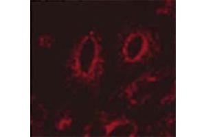 Immunocytochemistry/Immunofluorescence analysis using Mouse Anti-LAMP1 Monoclonal Antibody, Clone Ly1C6 . (LAMP1 Antikörper  (Atto 594))