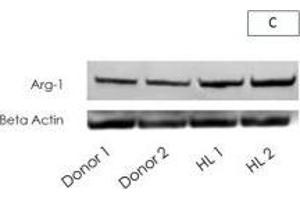 Western Blotting (WB) image for anti-Arginase, Liver (ARG1) antibody (ABIN2856661)