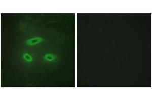 Immunofluorescence analysis of HeLa cells, using NKTR Antibody. (NKTR Antikörper  (AA 784-833))