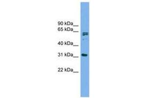 Image no. 1 for anti-MIT, Microtubule Interacting and Transport, Domain Containing 1 (MITD1) (AA 179-228) antibody (ABIN6744989) (MITD1 Antikörper  (AA 179-228))