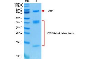 SDS-PAGE (SDS) image for GARP & Latent TGF beta 1 Complex (AA 20-628) protein (His-Avi Tag) (ABIN7274705)