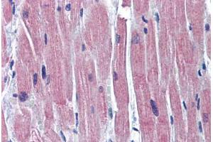 Human Heart: Formalin-Fixed, Paraffin-Embedded (FFPE) (TNNI3 Antikörper  (C-Term))