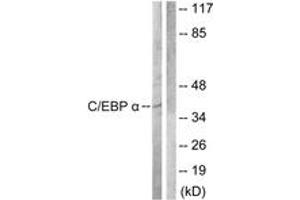 Western Blotting (WB) image for anti-CCAAT/enhancer Binding Protein (C/EBP), alpha (CEBPA) (AA 192-241) antibody (ABIN2888784) (CEBPA Antikörper  (AA 192-241))