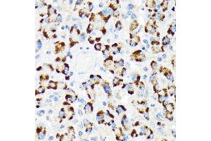 Immunohistochemistry of paraffin-embedded human liver using A-RAF Rabbit mAb (ABIN7271263) at dilution of 1:100 (40x lens). (ARAF Antikörper)