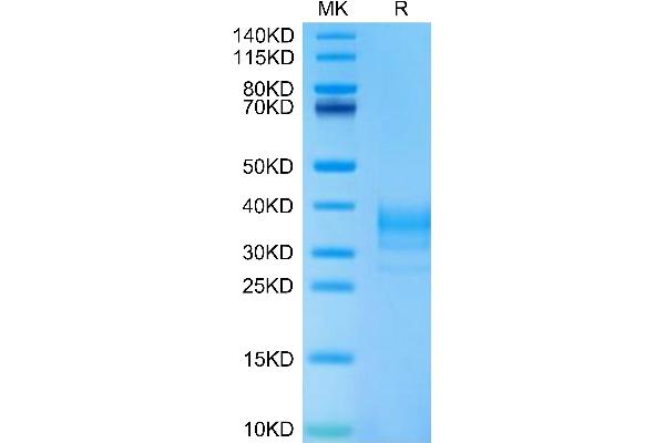 LAMP5 Protein (AA 30-235) (His tag)