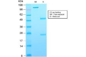 SDS-PAGE (SDS) image for anti-CD63 (CD63) antibody (ABIN6941234)