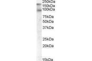ABIN2561770 (1µg/ml) staining of Human Colon lysate (35µg protein in RIPA buffer). (CDCP1 Antikörper  (C-Term, Isoform 1))