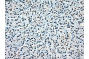 Immunohistochemical staining of paraffin-embedded lung tissue using anti-PLK1mouse monoclonal antibody. (PLK1 Antikörper)