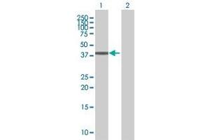 Lane 1: TMOD1 transfected lysate ( 39. (TMOD1 293T Cell Transient Overexpression Lysate(Denatured))