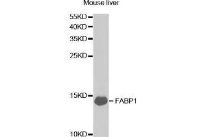 Western Blotting (WB) image for anti-Fatty Acid Binding Protein 1, Liver (FABP1) antibody (ABIN1876499) (FABP1 Antikörper)
