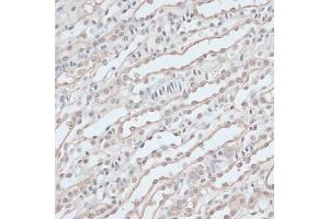 Immunohistochemistry of paraffin-embedded mouse kidney using ZNF597 antibody  at dilution of 1:100 (40x lens). (ZNF597 Antikörper  (AA 1-140))