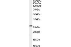 Western Blotting (WB) image for anti-Gap Junction Protein, beta 2, 26kDa (GJB2) (C-Term) antibody (ABIN2465763) (GJB2 Antikörper  (C-Term))