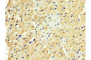 IHC image of ABIN7152350 diluted at 1:500 and staining in paraffin-embedded human heart tissue performed on a Leica BondTM system. (SOD3 Antikörper  (AA 19-160))