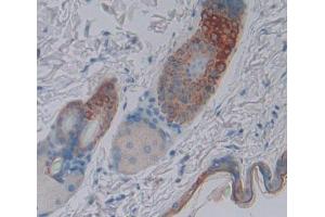 IHC-P analysis of skin tissue, with DAB staining. (SCEL Antikörper  (AA 410-652))