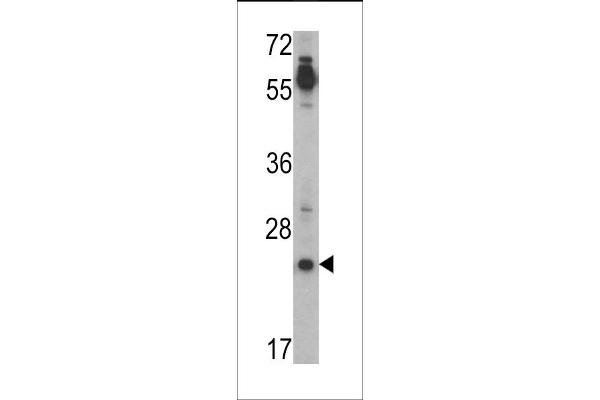 TDGF1 Antikörper  (N-Term)