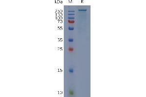 Human FN1, His Tag on SDS-PAGE under reducing condition. (Fibronectin 1 Protein (FN1) (AA 32-2477) (His tag))
