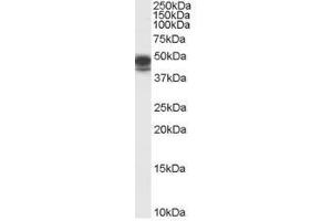 Image no. 1 for anti-Paired Box 8 (PAX8) (Internal Region) antibody (ABIN374803) (PAX8 Antikörper  (Internal Region))