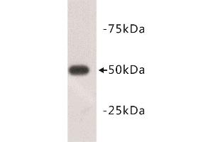 Western Blotting (WB) image for anti-Tubulin, beta 3 (TUBB3) (N-Term) antibody (ABIN1854950) (TUBB3 Antikörper  (N-Term))