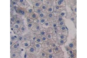 Used in DAB staining on fromalin fixed paraffin- embedded Kidney tissue (SLC22A4 Antikörper  (AA 42-141))