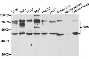 Western blot analysis of extracts of various cell lines, using GRN antibody (ABIN5973395) at 1/1000 dilution. (Granulin Antikörper)