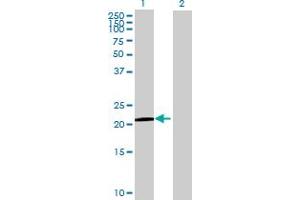 Lane 1: BCL2L10 transfected lysate ( 22. (BCL2L10 293T Cell Transient Overexpression Lysate(Denatured))