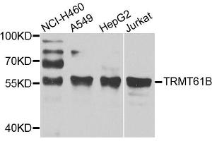 Western blot analysis of extracts of various cell lines, using TRMT61B antibody. (TRMT61B Antikörper)