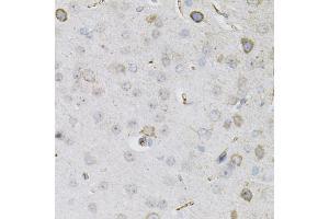 Immunohistochemistry of paraffin-embedded mouse brain using CEACAM5 antibody (ABIN6291892) (40x lens). (CEACAM5 Antikörper)