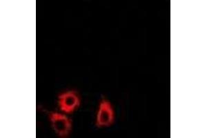 Immunofluorescence (IF) image for anti-SET and MYND Domain Containing 4 (SMYD4) (AA 1-260) antibody (ABIN5936313) (SMYD4 Antikörper  (AA 1-260))