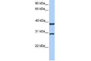 KLHDC1 antibody used at 1 ug/ml to detect target protein. (KLHDC1 Antikörper  (N-Term))