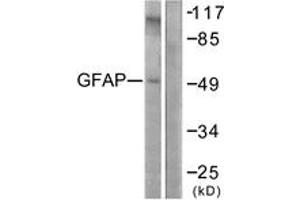 Western blot analysis of extracts from COLO205 cells, using GFAP (Ab-38) Antibody. (GFAP Antikörper  (AA 11-60))