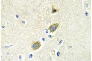 Image no. 2 for anti-Growth Arrest-Specific 6 (GAS6) antibody (ABIN317613) (GAS6 Antikörper)