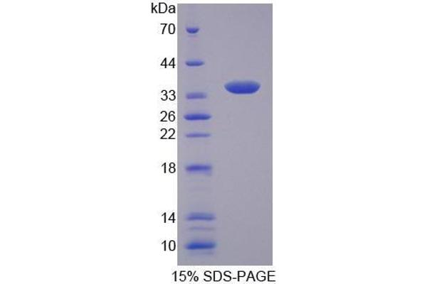 Slc25a1 Protein