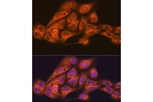 Immunofluorescence analysis of U-2 OS cells using CLOCK Rabbit mAb (ABIN7266414) at dilution of 1:100 (40x lens). (CLOCK Antikörper)