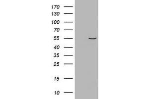 Image no. 1 for anti-Vimentin (VIM) (AA 210-466) antibody (ABIN1491201) (Vimentin Antikörper  (AA 210-466))