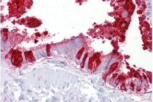 Immunohistochemistry with Lung, respiratory epithelium tissue at an antibody concentration of 5µg/ml using anti-SCGB1A1 antibody (ARP41524_P050) (SCGB1A1 Antikörper  (Middle Region))