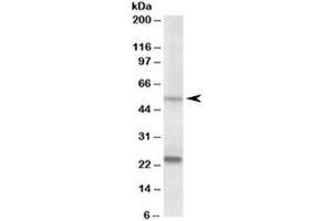 Western blot testing of prostate lysate with MMP3 antibody at 0. (MMP3 Antikörper)