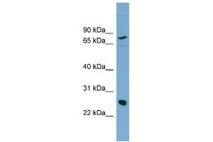 KLK5 antibody used at 1 ug/ml to detect target protein. (Kallikrein 5 Antikörper  (N-Term))