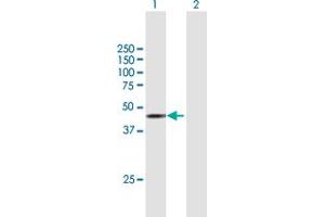 Western Blot analysis of STK17B expression in transfected 293T cell line by STK17B MaxPab polyclonal antibody. (DRAK2 Antikörper  (AA 1-372))