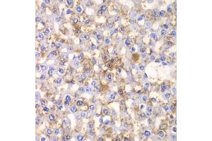 Immunohistochemistry of paraffin-embedded rat liver using H antibody (ABIN6129787, ABIN6141601, ABIN6141603 and ABIN6216048) at dilution of 1:100 (40x lens). (HAPLN1 Antikörper  (AA 165-354))