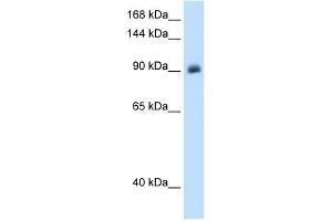 WB Suggested Anti-NR3C2 Antibody Titration:  1. (NR3C2 Antikörper  (Middle Region))