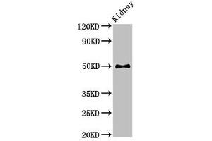 Western Blot Positive WB detected in: Mouse kidney tissue All lanes: PDK1 antibody at 2. (PDPK1 Antikörper  (AA 294-432))