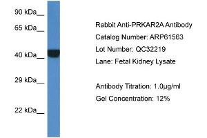 Western Blotting (WB) image for anti-Protein Kinase, CAMP-Dependent, Regulatory, Type II, alpha (PRKAR2A) (Middle Region) antibody (ABIN786444) (PRKAR2A Antikörper  (Middle Region))
