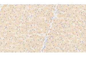 Detection of CD40L in Human Liver Tissue using Polyclonal Antibody to Cluster Of Differentiation 40 Ligand (CD40L) (CD40 Ligand Antikörper  (AA 1-261))