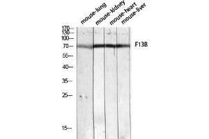 Western Blot (WB) analysis of Mouse Lung Mouse Kidney Mouse Heart Mouse Liver lysis using F13B antibody. (F13B Antikörper)