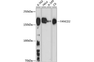 Western blot analysis of extracts of various cell lines, using F antibody (ABIN7267126) at 1:1000 dilution. (FANCD2 Antikörper)