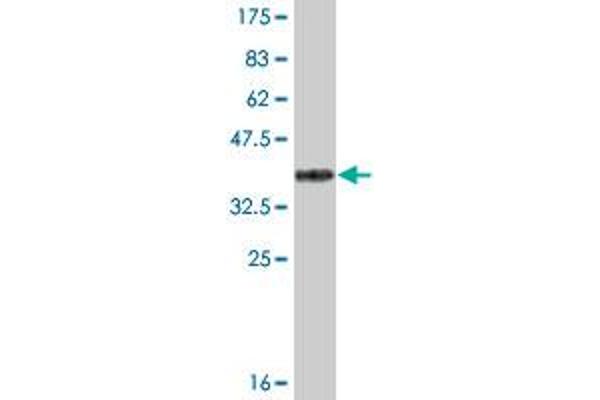 Acetyl-CoA Carboxylase beta Antikörper  (AA 22-120)